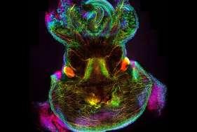 Agrandir l'image - fenêtre modale